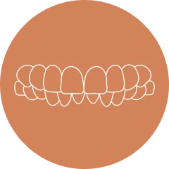 ディープバイト